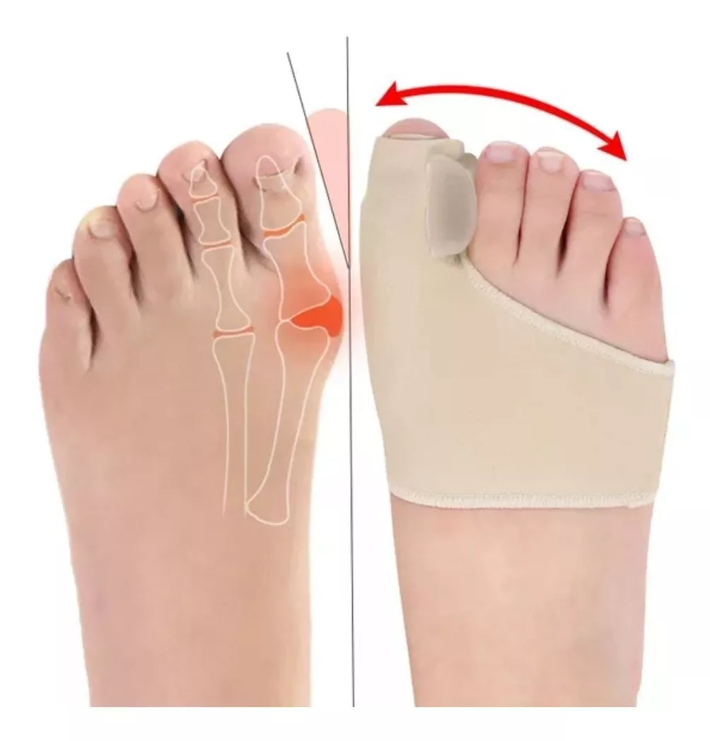 OrthoStep™ | Corrector de Juanetes (2 PZAS)